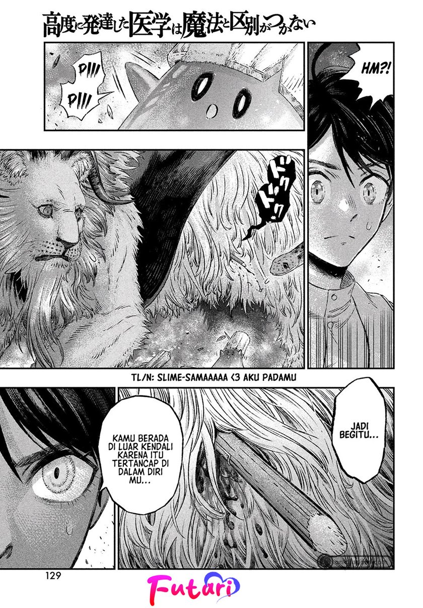 Koudo ni Hattatsu Shita Igaku wa Mahou to Kubetsu ga Tsukanai ANAFILAKSIS DAN ANTIGEN 第31页