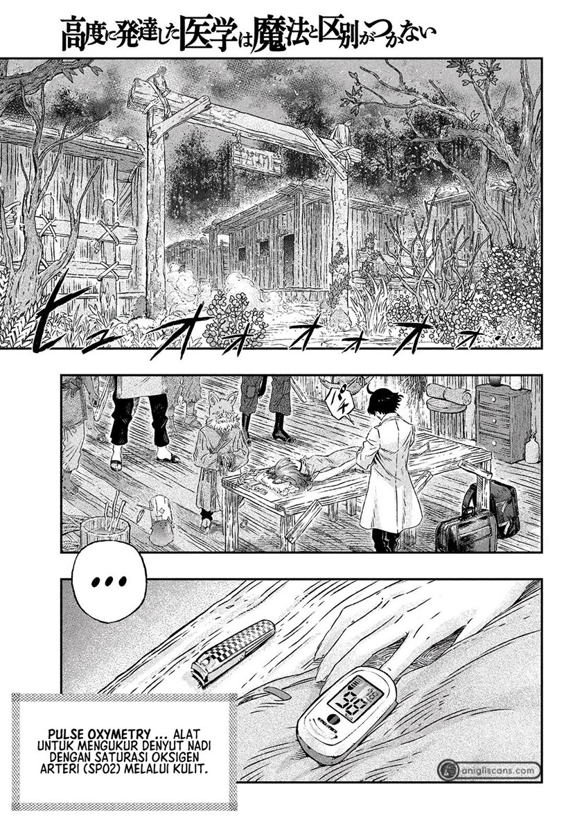 Koudo ni Hattatsu Shita Igaku wa Mahou to Kubetsu ga Tsukanai ANAFILAKSIS DAN ANTIGEN 第9页