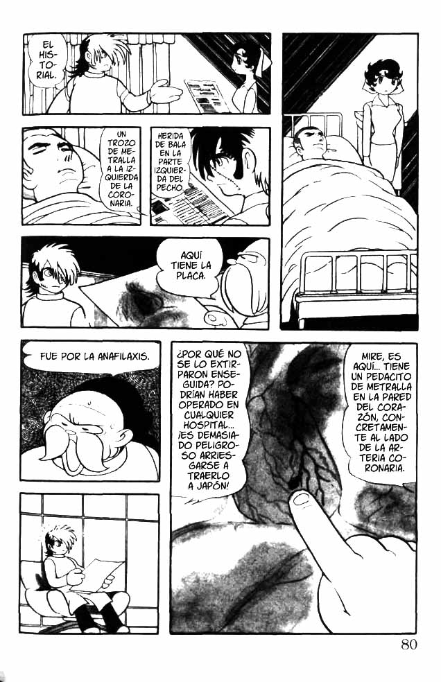 Black Jack Anafilaxis 第4页